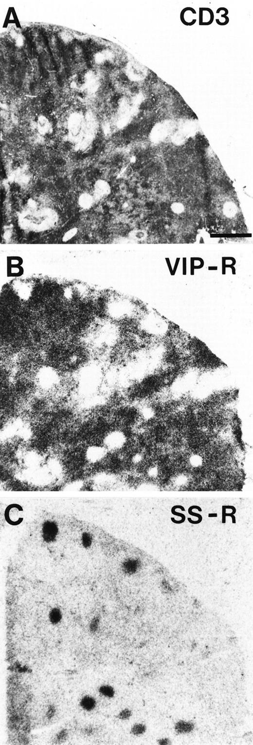 Fig. 3. Complementary localization of VIP receptors and SS receptors in a human lymph node. (A) CD3 immunohistochemical staining. Bar = 1 mm. (B) Autoradiogram showing total binding of125I-VIP. VIP receptors are in the whole lymph node with exception of the germinal centers. (C) Autoradiogram showing total binding of 125I-Tyr3-octreotide. SS receptors are predominantly located in germinal centers.
