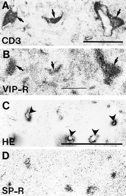 Fig. 5. Localization of VIP receptors and SP receptors in the human spleen. (A) CD3 immunohistochemical staining of the periarterial lymphatic sheaths (arrows). Bar = 1 mm. (B) Autoradiogram showing total binding of 125I-VIP. Preferential labeling is seen in the periarterial lymphatic sheets (arrows). Nonspecific binding is negligible. (C) Hematoxylin-eosin staining showing several central arteries (arrowheads) Bar = 1 mm. (D) Autoradiogram showing total binding of 125I-BH-SP. Only the central arteries are labeled. Nonspecific binding is negligible.