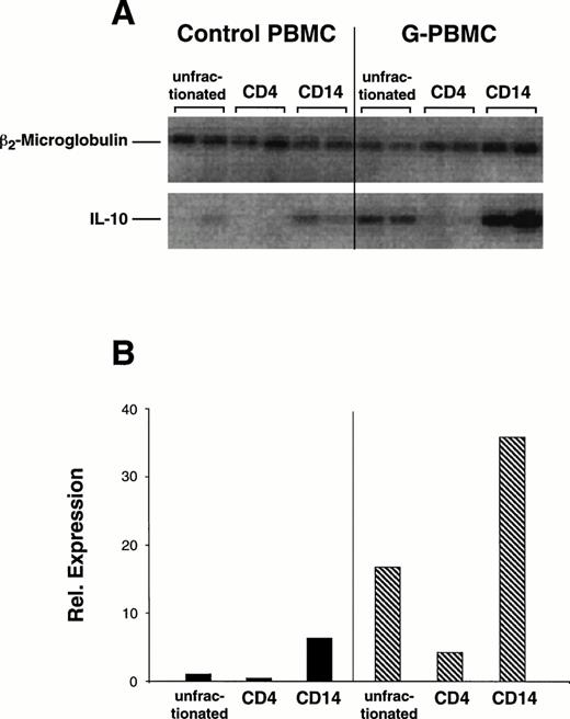 Fig. 5. Constitutive IL-10 mRNA and β2-microglobulin expression in control and G-PBMC. (A) RT-PCR for IL-10 and β2-microglobulin was performed from mRNA extracts of unfractionated PBMC or sorted CD4 and CD14 cells as described in Materials and Methods. The purity of sorted populations exceeded 96%. (B) Mean quantitations (ImageQuant software) of duplicate amplification products were normalized against signals obtained for β2-microglobulin. Shown is one of two experiments using paired control and G-PBMC samples from each of two donors.
