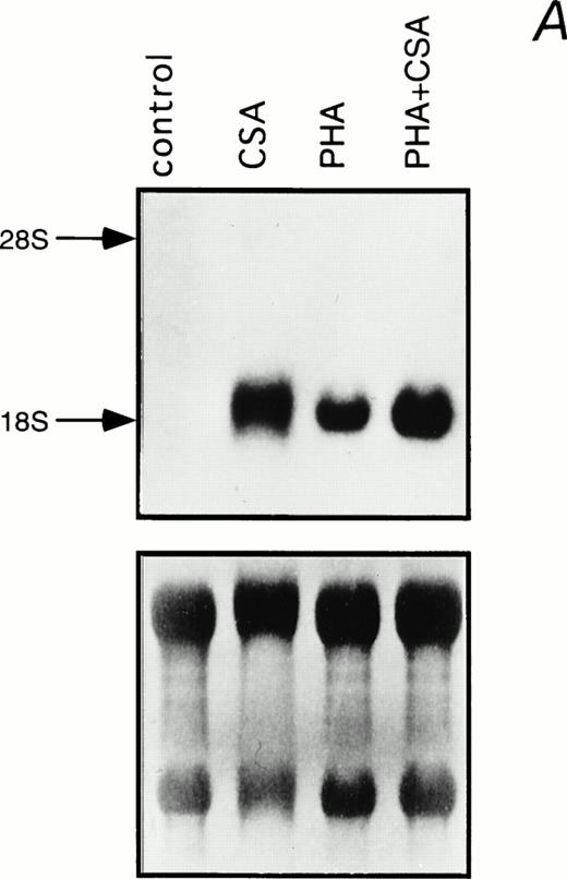 Fig. 2. Induction of IL-1β mRNA in human PBMC exposed to CSA. (A) Total RNA isolated from PBMC cultured in the presence of CSA (1 mg/mL), PHA (1 μg/mL), or both, was subjected to Northern blot hybridization using IL-1β cDNA as a probe. The positions of the 28S and 18S ribosomal RNAs are indicated. Relative amounts of RNA loaded in each lane are visualized in the lower panel by methylene blue staining. (B) The intensities of the IL-1β hybridization signals shown in (A) were measured using an InstantImager analyzer, and the results were plotted as a histogram to highlight the relative IL-1β mRNA levels.