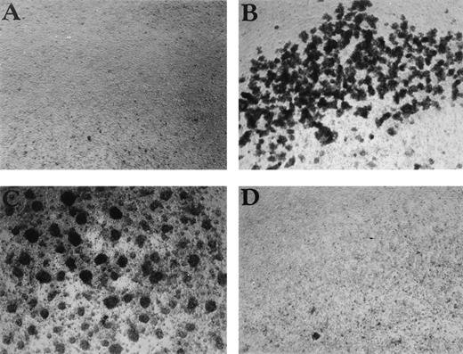 Fig. 4. CSB enhances cell aggregation in PBMC cultures. The effect of (A) control, (B) CSB (1 mg/mL), (C) PHA (1 μg/mL), and (D) HA (10 μg/mL) on PBMC aggregation is shown. PBMC were cultured in 24-well plates for 24 hours, and the cultures were then examined by phase microscopy using a Nikon Phase Contrast ELWD 0.3 microscope (original magnification × 100).