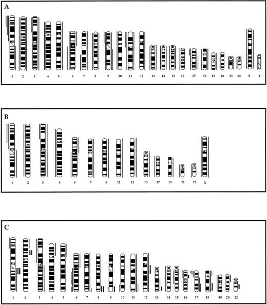 Fig. 1. Partial ideograms comparing the recurring chromosomal gains and losses detected by G-banding in 72 of the 96 tumors assayed for gene amplification (A), the subset of 20 tumors assayed by CGH (B), and gains and loses detected by CGH in the same subset of 20 tumors (C). Thin vertical lines on either side of the chromosome ideogram indicate only recurrent gains (right) or losses (left) of a chromosome or a chromosomal region. Gains/losses were considered recurrent if observed in two or more tumors. Thick lines in (C) indicate regions of high copy number (amplification) as defined in the text.