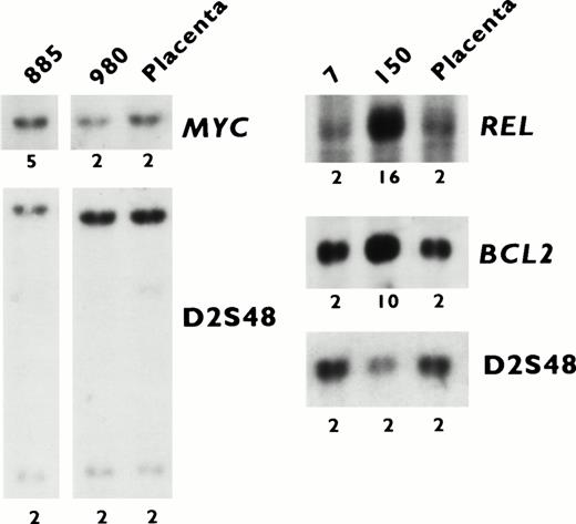 Fig. 3. Southern blot analysis of DNA extracted from tumors (7, 150, 885, and 980) and normal placenta with MYC, REL,BCL2, and D2S48 probes. The calculated copy numbers are listed. Tumor 150 exhibited amplification of 2p12-16 (REL) and 18q21-22 (BCL2), and tumor 885 exhibited amplification of 8q24 (MYC) by CGH.