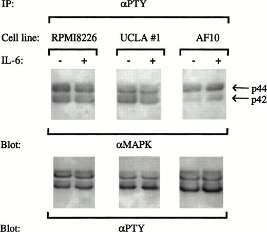 Fig. 4. Protective concentrations of IL-6 do not induce tyrosine phosphorylation of ERK-1 or ERK-2. 8226, UCLA #1, and AF-10 cells were treated with or without IL-6 (1,000 U/mL) for 15 minutes and extracts were immunoprecipitated with an antiphosphotyrosine antibody (IP:αPTY). Immunoprecipitates were then blotted with anti-ERK antibodies (anti-MAPK, upper blot) and with an antiphosphotyrosine antibody (αPTY, lower blot).