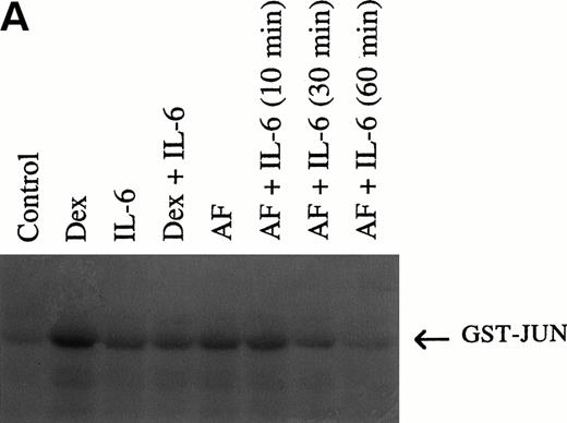 Fig. 6. (A) Anti-fas and dexamethasone activate and IL-6 inhibits jun kinase in 8226 cells. 8226 MM cells incubated in media (control) or dexamethasone alone (10−6 mol/L), IL-6 (1,000 U/mL) alone, dexamethasone + IL-6 (IL-6 present for 60 minutes followed by dexamethasone for 10 minutes, anti-fas alone (0.5 μg/mL for 10 minutes), or anti-fas + IL-6 where IL-6 is present for 10, 30, or 60 minutes before addition of anti-fas. Whole-cell lysates were then tested for enzymatic activity against GST-jun in an in vitro kinase assay. (B) Coomassie blue staining of gel shown in (A) to confirm equal protein loading.