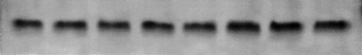 Fig. 6. (A) Anti-fas and dexamethasone activate and IL-6 inhibits jun kinase in 8226 cells. 8226 MM cells incubated in media (control) or dexamethasone alone (10−6 mol/L), IL-6 (1,000 U/mL) alone, dexamethasone + IL-6 (IL-6 present for 60 minutes followed by dexamethasone for 10 minutes, anti-fas alone (0.5 μg/mL for 10 minutes), or anti-fas + IL-6 where IL-6 is present for 10, 30, or 60 minutes before addition of anti-fas. Whole-cell lysates were then tested for enzymatic activity against GST-jun in an in vitro kinase assay. (B) Coomassie blue staining of gel shown in (A) to confirm equal protein loading.