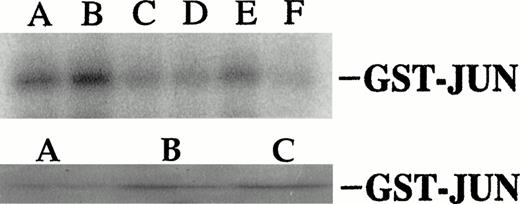 Fig. 7. (A) Dexamethasone and anti-fas activate and IL-6 inhibits jun kinase activity in UCLA #1 cells. Top band: UCLA #1 cells were incubated in dexamethasone alone (lane A, 10−6 mol/L, for 10 minutes), anti-fas alone (lane B, 0.5 μg/mL for 10 minutess), media alone (control, lane C), dexamethasone (10−6 mol/L) + IL-6 (lane D, IL-6 at 1,000 U/mL present for 60 minutes before addition of dexamethasone), anti-fas + IL-6 (lane E, IL-6 present for 10 minutes before anti-fas), or anti-fas + IL-6 (lane F, IL-6 present for 60 minutes before anti-fas). In vitro kinase assay performed for jun kinase activity as shown in Fig 6. Bottom band: UCLA #1 cells incubated in media (lane A), dexamethasone (10−6 mol/L, lane B), or anti-fas (0.5 μg/mL, lane C) for 10 minutes. Jun kinase then immunoprecipitated from protein lysates and tested against GST-jun in in vitro kinase assay. (B) Coomassie blue staining of gel shown in upper band of (A).