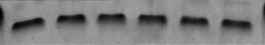 Fig. 7. (A) Dexamethasone and anti-fas activate and IL-6 inhibits jun kinase activity in UCLA #1 cells. Top band: UCLA #1 cells were incubated in dexamethasone alone (lane A, 10−6 mol/L, for 10 minutes), anti-fas alone (lane B, 0.5 μg/mL for 10 minutess), media alone (control, lane C), dexamethasone (10−6 mol/L) + IL-6 (lane D, IL-6 at 1,000 U/mL present for 60 minutes before addition of dexamethasone), anti-fas + IL-6 (lane E, IL-6 present for 10 minutes before anti-fas), or anti-fas + IL-6 (lane F, IL-6 present for 60 minutes before anti-fas). In vitro kinase assay performed for jun kinase activity as shown in Fig 6. Bottom band: UCLA #1 cells incubated in media (lane A), dexamethasone (10−6 mol/L, lane B), or anti-fas (0.5 μg/mL, lane C) for 10 minutes. Jun kinase then immunoprecipitated from protein lysates and tested against GST-jun in in vitro kinase assay. (B) Coomassie blue staining of gel shown in upper band of (A).