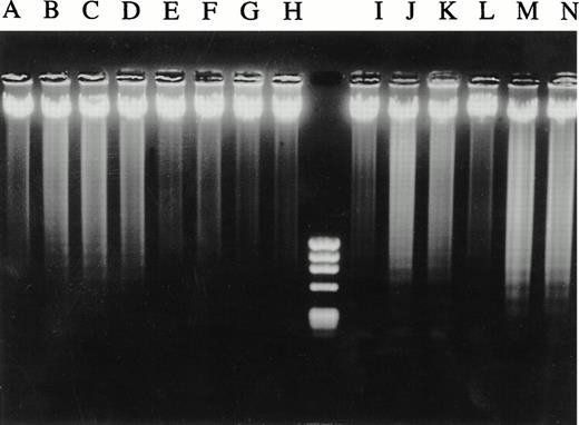 Fig. 10. Mutant c-jun–containing 8226 cells are protected from anti–fas-induced DNA laddering but not from dexamethasone. Neo control (lanes A through D and I through K) and mutant c-jun–transduced 8226 cells (lanes E through H and L through N) were cultured in media for 20 hours (lanes A and E) or 48 hours (lanes I and L) or with increasing concentrations of anti-fas (0.1, 0.25, 0.5 μg/mL, lanes B through D and F through H) or with dexamethasone (10−6 mol/L and 2 × 10−6 mol/L, lanes J and K and M and N, respectively). DNA was then extracted and electrophoresed.