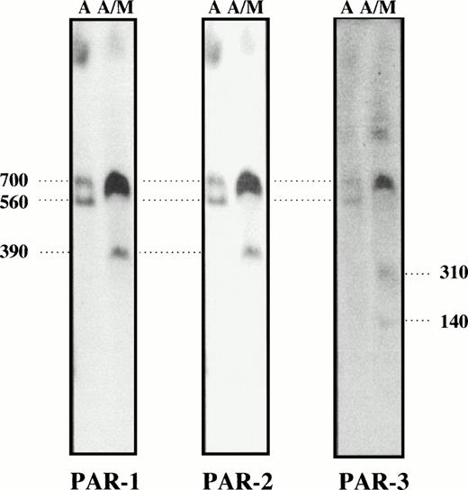 Fig. 4. PFGE analysis of Asc I and AscI/Mlu I fragments from BJ DNA. The Asc I fragments (700 and 560 kb) are common for the three probes showing the existence of a PAR cluster. The double digest gave a partial 700-kb Asc I fragment, the smaller 560-kb fragment was not detected. Asc I shows marked site preference, and we obtained variable amounts of cleavage at this site in different digests. The AscI/Mlu I digest shows that PAR-3 is located at one end of the PAR cluster. PAR-1 and PAR-2 are located on a 390-kb fragment while PAR-3 is seen on a separate 310-kb fragment (and on a shorter 140-kb fragment). PFGE conditions: ramp from 110 to 140 seconds for 64 hours.