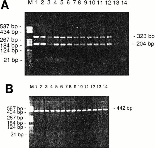 Fig. 5. (A) Representative IL-15 RT-PCR results from the three CTCL cell lines HUT78, MyLa, SeAx, and Sézary cells from nine patients. M, Boehringer marker V; the sizes of the most important marker bands are given on the left. Lanes 1 through 3, the cell lines MyLa, HuT 78, and SeAx; lanes 4 through 12, Sézary cells from nine patients; lane 13, PBLs of a healthy donor; lane 14, monocyte-depleted PBLs of a healthy donor. (B) Corresponding results of a β-actin PCR, which served as a control. The sizes of the RT-PCR products are given on the left.