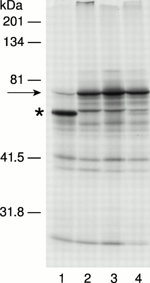 Fig. 1. (A). Analysis of bone marrow and EBV cell-line DNA from patient 6 and DNA extracted from the blood of his parents. Lanes 1 through 4 were analyzed using the polymorphic nucleotide repeat described by Andersen et al.36 Lane 1 shows maternal DNA, lane 2 shows paternal DNA, lane 3 shows EBV-line DNA, and lane 4 shows DNA extracted from leukemic bone marrow. The patient's EBV line, which is not involved in the leukemic clone, retains both parentalNF1 alleles, whereas the affected bone marrow sample shows a single allele consistent with LOH at NF1 in this leukemia. (B). Results of the IVTT assay in patient 6. Lanes 1 to 4 show polypeptides synthesized from RT-PCR product corresponding to exons 28 through 38 of the NF1 coding sequence. The sample in lane 1 is derived from patient 6; samples in lanes 2 through 4 show a normal protein pattern. The full-length polypeptide is indicated by an arrow. The truncated protein in lane 1, marked by an asterisk, represents the 6579 + 18 G to A mutation seen in the splice consensus sequence flanking exon 34 ofNF1 in this patient. The full-length IVTT polypeptide in this patient is represented by a fainter band than is seen in lanes 2 to 4, consistent with loss of the normal NF1 allele in this leukemia.