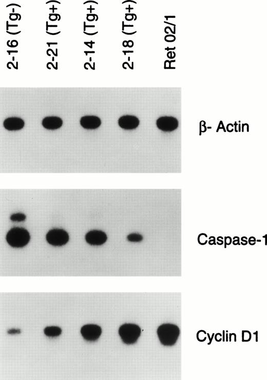 Fig. 7. RT-PCR analysis of gene expression of β-actin, CASPASE-1, and CYCLIN D1 in the sorted late pro–B cells (Fr C) of 13-week-old well-appearing Eμ-ret (Tg+) and transgene-negative littermates (Tg−) mice. Ret 02/1 is a pro–B-cell leukemia line derived from an Eμ-ret mouse. The autoradiograms shown represent 30-minute to 1-hour exposures of 22 (β-actin) or 26 cycles (CASPASE-1 and CYCLIN D1) of amplification.
