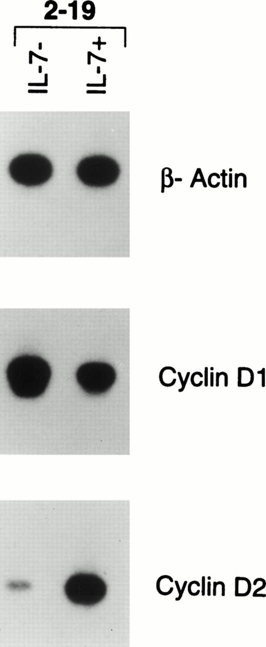 Fig. 8. RT-PCR analysis of gene expression of β-actin, CYCLIN D1, and CYCLIN D2 in the pro–B-cell leukemia of an Eμ-ret mouse. Bone marrow was recovered from an Eμ-ret mouse (2-19) with adenopathy and splenomegaly and directly cultured for 4 days with or without IL-7 (100 U/mL). The cells survived without proliferation in media without IL-7 and proliferated fourfold in media supplemented with IL-7. The autoradiograms shown represent 30-minute exposures of 22 (β-actin) or 30 cycles (CYCLINS) of amplification.