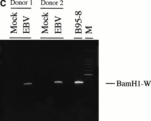 Fig. 2. (A) Detection of EBV genome in human neutrophils. Cells were incubated for increasing time periods before DNA isolation and Southern blot analysis. EBV DNA was detected by hybridization with aBamHI W probe. Raji cell line was used as positive control. Neutrophils were either cultured in absence (control) or in presence of EBV (15 minutes and 2, 5, 10, and 24 hours). The experiment is representative of two other experiments. (B) Densitometric analysis of viral DNA levels in EBV-infected neutrophils. Results are the mean of three experiments. (C) Detection of EBV genome in isolated nuclei. Neutrophils from two healthy donors were preincubated with the phagocytosis inhibitor cytochalasin B (10 μmol/L) for 15 minutes and then treated with EBV or culture medium (mock) for 10 hours. Cells were obtained and genomic DNA was extracted from purified nuclei. EBV genomic DNA was detected by PCR as described in Materials and Methods. B95-8 cells were used as positive control. M represents a 100-bp molecular weight marker.