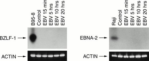Fig. 3. RT-PCR analysis of viral BZLF-1 and EBNA-2 mRNA expression. Neutrophils were incubated in absence (control) or in presence of EBV for various times (15 minutes and 5, 10, and 20 hours). Total RNA was reverse transcribed and amplified using specific BZLF-1 and EBNA-2 primers as described in Materials and Methods. Control cells were the EBV+ B95-8 cells line for BZLF-1 analysis and the EBV+ Raji cells line for EBNA-2 analysis. Amplification were Southern blotted and probed as described in Materials and Methods. The size of PCR products are 182 bp for BZLF-1 and 381 bp for EBNA-2. Results are representative of three different donors.