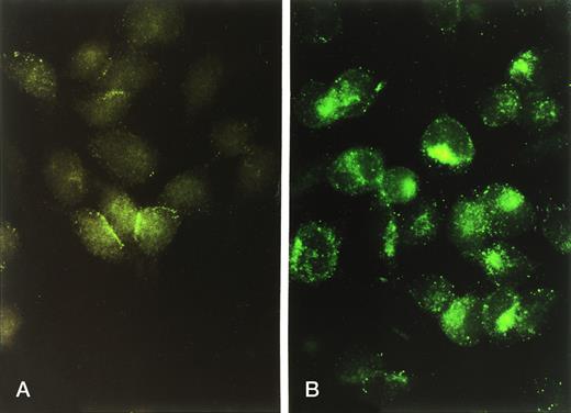 Fig. 2. Indirect immunofluorescent staining of human CR1 in intact (A) versus permeabilized (B) RBL-CR1 cells. Cells were stained as in Fig 1A and B, respectively, and prepared for microscopy as described in Materials and Methods.