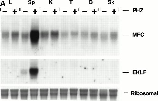 Fig. 3. Mouse ferrochelatase and reporter gene expression in various nonerythroid and erythroid tissues. (A) Total RNA was isolated from liver (L), spleen (Sp), kidney (K), testis (T), brain (B), and skeletal muscle (Sk) from control (PBS-treated) or PHZ-treated mice. A total of 15 μg of total RNA was analyzed by Northern blot. RNA was probed for mouse ferrochelatase mRNA or EKLF mRNA with radiolabeled mouse ferrochelatase or human EKLF cDNA probes. Equal loading of RNA was assessed by ethidium bromide staining of 18S and 28S ribosomal RNA. (B) 3.0-mm3 fragments of various tissue described above plus marrow from control-treated (PHZ-, hatched bars) or PHZ-treated (solid bars) −4.0 TG mice were homogenized in luciferase assay buffer. Luciferase activity of tissue extracts was measured for 10 seconds in a luminometer and expressed as relative light units per μg of protein. Luciferase activity in erythroid tissues is expressed on a scale 100 times that of nonerythroid tissues. Each luciferase activity data point represents an average of two to three mice.