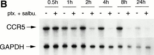 Fig. 2. Modulation of CCR5 mRNA expression by salbutamol and/or pentoxifylline. (A) Monocytes were incubated for 4 hours with medium, salbutamol, pentoxifylline, or both drugs. Northern blot analysis of CCR5 mRNA expression is illustrated. (B) Cells were incubated with medium or the combination of pentoxifylline (ptx) and salbutamol (salbu) for the indicated time periods and CCR5 mRNA expression was analyzed by Northern blot. n = 2 to 4 independent experiments.