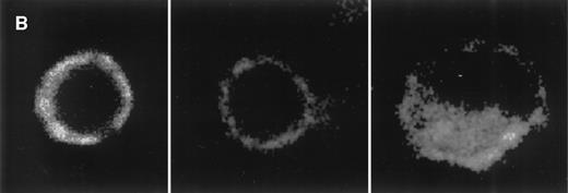 Fig. 3. CCR5 protein expression on monocytes. (A) Flow cytometry analysis: Monocytes were incubated for 48 hours with medium or PGE2 (10−5 mol/L) before labeling either with FITC-conjugated goat anti-mouse antibody alone (dotted line) or with anti-CCR5 (2D7) antibody followed by FITC-conjugated goat anti-mouse antibody (untreated cells: thick line; PGE2-treated cells: thin line). Representative experiment of eight independent experiments. (B) Laser confocal microscopy: Monocytes were incubated for 48 hours with medium (left) or PGE2 (10−5 mol/L) (middle) before permeabilization and labeling with anti-CCR5 (2D7) antibody followed by rhodamine-conjugated goat anti-mouse antibody. For comparison, monocytes incubated with medium for 48 hours were stimulated with MIP-1β (100 ng/mL) for 30 minutes before labeling, to illustrate CCR5 internalization (right).