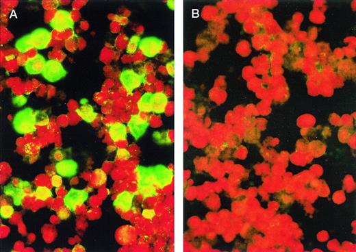 Fig. 1. KS-1 cells (p39) were air-dried onto slides and fixed with acetone. Plasmas were diluted 1:20 with PBS. In (A), the cells were stained with a plasma from a classic KS patient; in (B), with plasma from a blood donor. FITC-conjugated goat antihuman IgG was used as the secondary antibody. Cells were photographed at original magnification × 400. Green staining cells indicate presence of HHV-8 antigens.