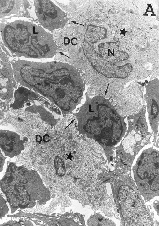 Fig. 4. Ultrastructure of DC. DC appear as large, irregular elements showing a lobulated nucleus (N), and an electron-lucent cytoplasm with few organelles (stars) arranged close to the nucleus. Note the interdigitating cell processes in close contact (arrows) with the neighboring lymphocytes (L) (A; original magnification ×3,400). Immature DC exhibit shorter cell processes, a less irregular but usually indented nucleus, and membranous organelles scattered throughout the cytoplasm (B; original magnification ×7,900).