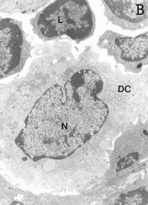 Fig. 4. Ultrastructure of DC. DC appear as large, irregular elements showing a lobulated nucleus (N), and an electron-lucent cytoplasm with few organelles (stars) arranged close to the nucleus. Note the interdigitating cell processes in close contact (arrows) with the neighboring lymphocytes (L) (A; original magnification ×3,400). Immature DC exhibit shorter cell processes, a less irregular but usually indented nucleus, and membranous organelles scattered throughout the cytoplasm (B; original magnification ×7,900).