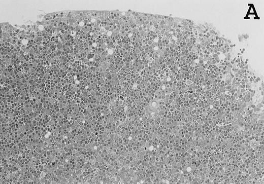 Fig. 3. Large numbers of DC develop in the presence of IL-7. Thymic lobes were organ-cultured under control conditions (original magnifications: A, 130×; B, 650×) or in the presence of IL-7 (original magnifications: C, 130×; D, 650×) for 12 days. Note the peripheral band of pale cells in IL-7–treated lobes (C). These cells mostly correspond to DC (asterisks; D). In contrast, thymocytes (arrows) predominate in control lobes (B).