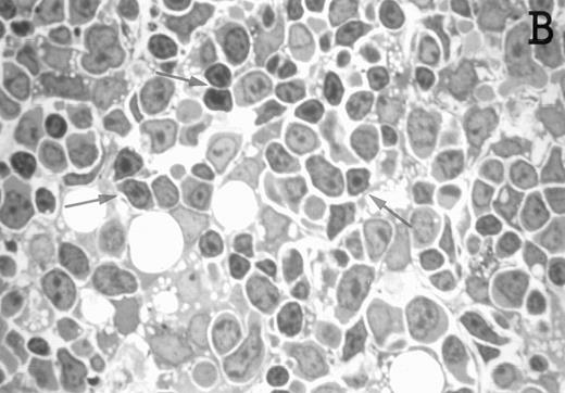 Fig. 3. Large numbers of DC develop in the presence of IL-7. Thymic lobes were organ-cultured under control conditions (original magnifications: A, 130×; B, 650×) or in the presence of IL-7 (original magnifications: C, 130×; D, 650×) for 12 days. Note the peripheral band of pale cells in IL-7–treated lobes (C). These cells mostly correspond to DC (asterisks; D). In contrast, thymocytes (arrows) predominate in control lobes (B).