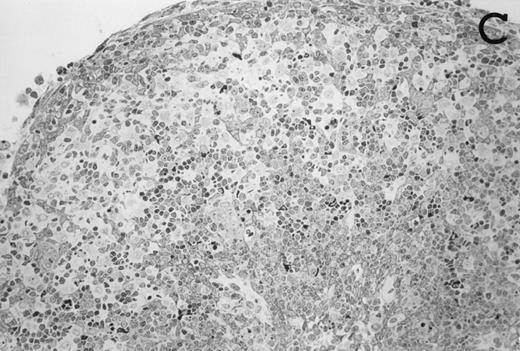 Fig. 3. Large numbers of DC develop in the presence of IL-7. Thymic lobes were organ-cultured under control conditions (original magnifications: A, 130×; B, 650×) or in the presence of IL-7 (original magnifications: C, 130×; D, 650×) for 12 days. Note the peripheral band of pale cells in IL-7–treated lobes (C). These cells mostly correspond to DC (asterisks; D). In contrast, thymocytes (arrows) predominate in control lobes (B).