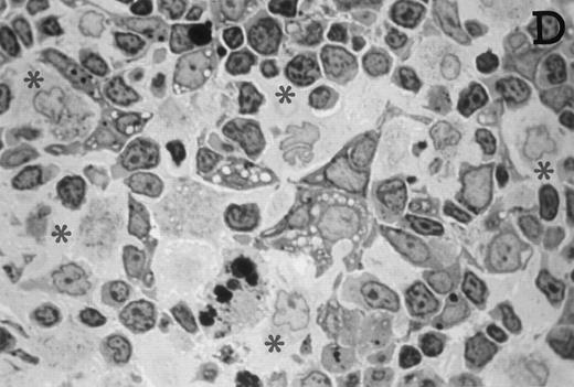 Fig. 3. Large numbers of DC develop in the presence of IL-7. Thymic lobes were organ-cultured under control conditions (original magnifications: A, 130×; B, 650×) or in the presence of IL-7 (original magnifications: C, 130×; D, 650×) for 12 days. Note the peripheral band of pale cells in IL-7–treated lobes (C). These cells mostly correspond to DC (asterisks; D). In contrast, thymocytes (arrows) predominate in control lobes (B).