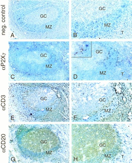 Fig. 4. Expression of P2X7 receptor in human tonsil by immunohistochemistry. Serial cryostat sections were processed to show the location of P2X7 receptors using the anti-P2X7 receptor MoAb. (A and B) Irrelevant isotype (IgG2b) control MoAb; (C and D) anti-P2X7 MoAb; (E and G) anti-CD3 (showing T cells) and anti-CD20 (showing B cells). (B), (D), (F), and (H) are higher magnifications of (A), (C), (E) and (G), respectively. GC, germinal center; MZ, marginal zone; T, T-cell zone. Inset in (D) shows a higher magnification of one of the positive cells in the marginal zone to detail the morphology.