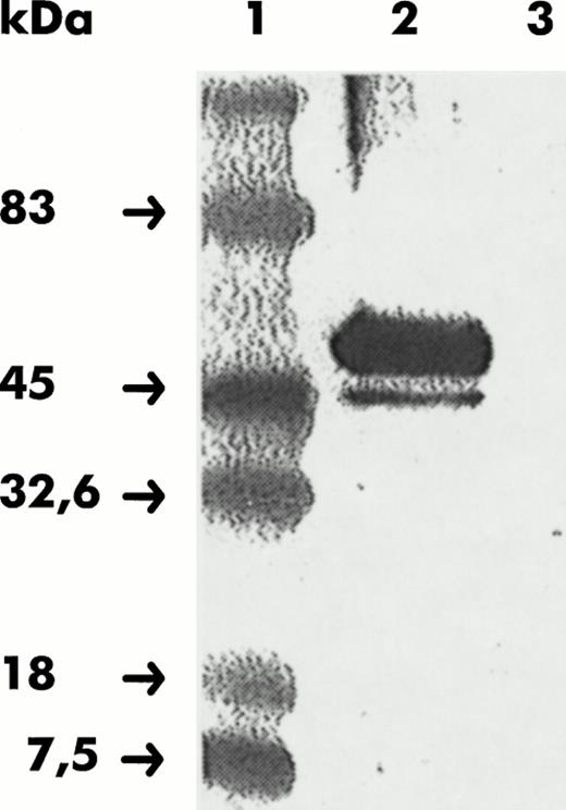 Fig. 1. Reactivity of CHO membranes to anti-CB2 receptor Abs assayed in Western blot. CHO-WT and CHO-CB2 membranes were resolved by SDS-PAGE, transferred to nitrocellulose, and shown with anti-CB2 receptor Abs raised against the C-terminal CB2 receptor peptide. Lane 1, molecular weight markers; lane 2, CHO-CB2 membranes; lane 3, CHO-WT membranes.