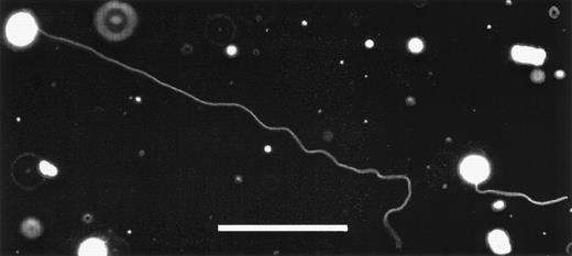 Fig. 3. Two KG1a cells displaying extremely long magnupodia. The total length of the podia extended by the cell on the left is over 330-μm long. The tip of one magnupod is out of focus, indicating that it is floating above the plane of focus. The scale bar in this image is 100-μm long. Enhancing the contrast of this image so that the podia become visible has also caused membrane fragments and debris to appear as bright objects.