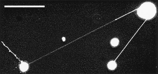 Fig. 5. Tenupods can extend toward other cells and appear to connect the membranes. In this image, tenupodia connect the membranes of 3 neighboring cells. The longest tenupod is 310-μm long. The scale bar is 100-μm long.