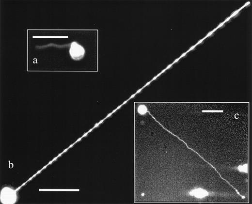 Fig. 6. Primary human CD34+ cells also display magnupodia and tenupodia. (a) A CD34+ cell from an umbilical cord blood source displaying a magnupod. (b) A human fetal liver CD34+ cell with a very long tenupod. (c) aBM CD34+ cell deploying a long magnupod. Scale bars in all images are 30-μm long.