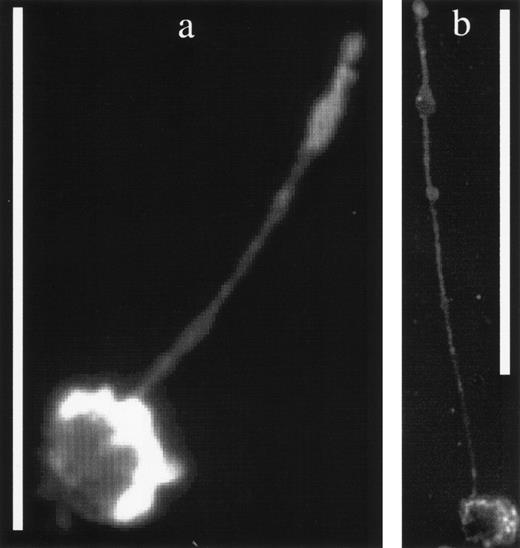 Fig. 7. (a) A KG1a cell displaying a magnupod that has been stained with an antibody against the CD34 surface marker. The scale bar is 50-μm long. (b) A similar KG1a cell stained for the presence of the CD44 antigen on its surface. The scale bar is 100-μm long. Note that the antibody staining of the cell bodies in these fluorescent images is not as bright as the PKH26 staining, resulting in more uniformly enhanced images.