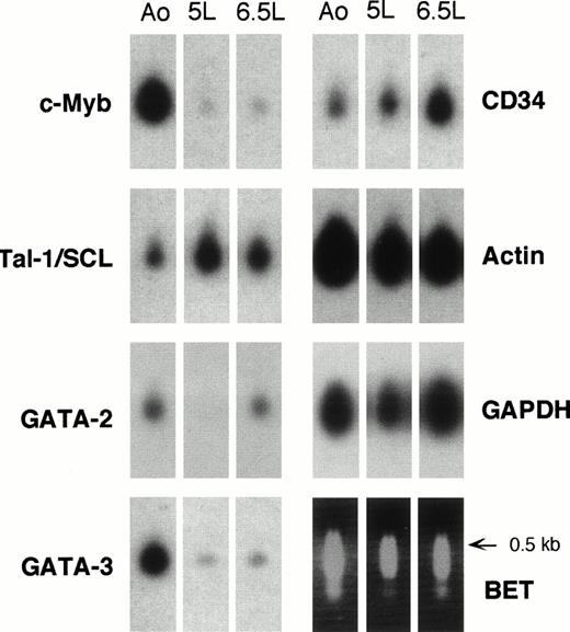 Fig. 5. Hybridization of probes for hematopoietic and housekeeping genes to cDNA samples from purified embryonic aorta-associated and liver HSCs. The lower right panel shows the set of samples stained with ethidium bromide before blotting onto nylon filters and probing with the indicated 32P-labeled cDNA probes. Autoradiography times were 1 to 2 hours for β-actinand GAPDH and 8 to 24 hours for hematopoietic genes. Ao, 5-week CD34+CD45+ aortic cells; 5L, 5-week CD34+CD45+ liver cells; 6.5L, 6.5-week CD34+CD38− liver cells.
