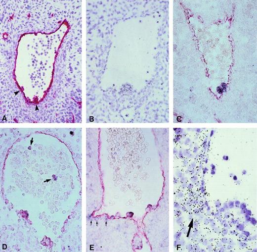 Fig. 1. Expression of hematopoietic transcription factors in CD34+ aorta-associated cells from 5-week human embryos. (A) Immunostaining with an anti-CD34 antibody. Arrowheads point to hematopoietic cell clusters in the aorta. Hematoxylin counter-staining (original magnification × 200). (B) Hybridization on an equivalent section of a tal-1/SCL radioactive probe. All cells in the intra-aortic cluster are specifically labeled (original magnification × 260). (C through E) Hybridization of DIG-labeled riboprobes (purple staining) specific for c-myb (C),GATA-2 (D), and GATA-3 (E). Further incubation of these sections with an anti-CD34 antibody (red staining) shows the coexpression of both markers in aorta-associated blood cell progenitors (original magnification × 260). Arrows in (D) point to circulatingGATA-2+ cells in the lumen of the aorta and those in E to a faint GATA-3 signal in mesenchymal cells subjacent to the ventral endothelium of the aorta. (F) GATA-3 labeling in mesenchymal cells underlying the ventral wall of the aorta is obvious using a 35S-radiolabeled probe (arrow). Note the higher expression of GATA-3 mRNA in the innermost cells within a large hematopoietic cluster (original magnification × 650). No signals were observed upon hybridization of sense riboprobes (not shown).