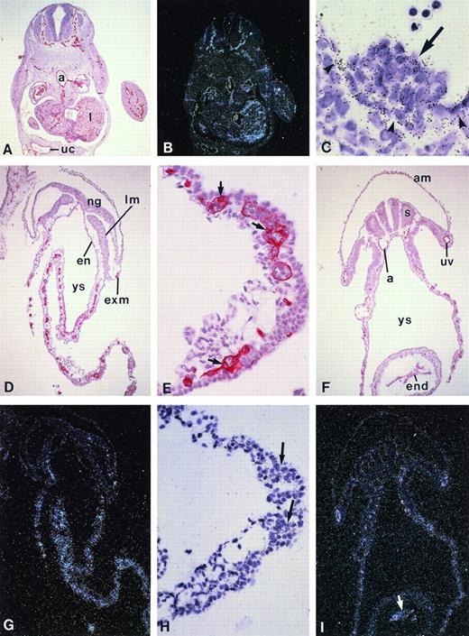 Fig. 6. KG-1 kinase expression pattern in the early human embryo and yolk sac. (A through C) Cross-sections through a 5-week human embryo. (A) CD34 immunostaining (red color) is present in the whole endothelial network of the embryo. (B) Dark field illumination of an adjacent section hybridized with the KG-1 kinase riboprobe shows identical expression pattern in blood vessels and capillaries (original magnification × 26). (C) High magnification of (B) in the region of the aorta that shows a hematopoietic cell cluster. Note that endothelial cells (arrowheads) and associated hematopoietic cells (arrow) are labeled, whereas no significant hybridization signal is detected on subaortic mesodermal cells (original magnification × 650). (D through F) CD34 expression on transverse sections of a 5-somite (D and E) and a 15-somite human embryo (F). (D) Section through the postsomitic region of a 5-somite embryo shows CD34+ cells in the yolk sac and extraembryonic mesoderm (original magnification × 65). (E) Detail of (D) in the yolk sac: flattened endothelial and round hematopoietic CD34+ cells are clearly visible in the yolk sac blood islands (arrows; original magnification × 260). (F) Section through the heart region of a 15-somite embryo. CD34 staining is obvious in the yolk sac, as well as in the endocardium and developing dorsal aortae and umbilical veins (original magnification × 65). (G, H, and I) Dark field illumination of sections adjacent to those shown, respectively, in (D), (E), and (F), hybridized with the KG-1 kinaseriboprobe: labeling parallels that of the CD34 antigen in both the yolk sac and embryo proper. (H) Higher magnification (original magnification × 260) of (G; original magnification × 65) showing compact aggregates of labeled cells in yolk sac blood islands. The arrow in (I) points to the labeling in the endocardium (original magnification × 65). No signal was observed upon hybridization of a sense riboprobe (not shown). a, dorsal aorta; am, amnios; en, endoderm; end, endocardium; ex.m, extraembryonic mesoderm; lm, lateral mesoderm; ng, neural grove; s, somite; uc, umbilical cord; uv, umbilical vein; ys, yolk sac.