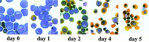 Fig. 4. Erythroid progenitor cells differentiate in vitro. Erythroid progenitor cells were induced to differentiate in the presence of Epo and insulin (see Materials and Methods). After 1, 2, 4, and 5 days of differentiation, cells were subjected to cytocentrifugation and staining with neutral benzidine and histological dyes and photographed. Day 0, undifferentiated cells cultured under standard growth conditions. Please note the enucleated cells obtained at day 4 to 5 of differentiation.