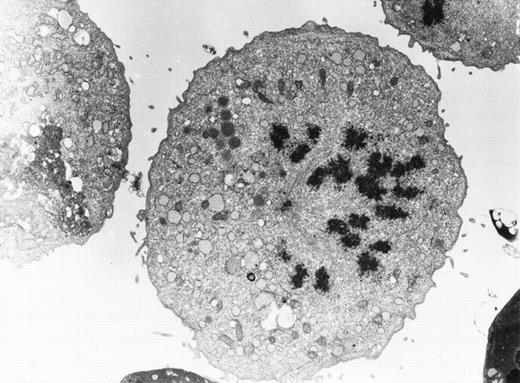 Mitotic figure of the CD34−, canine hematopoietic stem cell line D064 (Huss et al, Blood 85:2414, 1995 and Huss et al, Proc Natl Acad Sci USA 92:748, 1995). The spindle is attached to the condensed chromosomes, which are pulled apart by the centrioles. Original magnification ×10,000. (Courtesy of Ralf Huss, MD, Institute of Pathology, Ludwig-Maximilians-Universitat, Thalkirchner Strasse 36, Munich D-80337, Germany.)