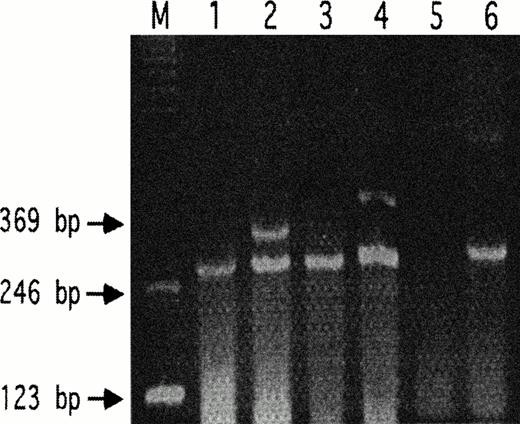 Fig. 1. Absence of PAR-3 and GPIb in B16F10 cells. RT-PCR are shown for wild-type B16F10 (lanes 1, 3, and 5) and mouse spleen (lanes 2, 4, and 6). HPRT was used as an internal standard in lanes 1 through 4 (expected product, 284 bp). Lanes 1 and 2 demonstrate the respective absence and presence of PAR-3 in B16F10 versus mouse spleen for the 341-bp PAR-3 primer product. Similar results are shown for lanes 3 and 4 using PAR-3 primers with the expected 397-bp product. Lanes 5 and 6 demonstrate the respective absence and presence of GPIb versus mouse spleen for the expected 290-bp product.