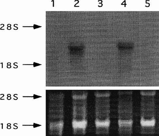 Fig. 2. Northern analysis of PAR-1 sense and antisense transfectants of B16F10 cells probed with 32P-dCTP–labeled thrombin receptor cDNA. Lane 1, wild-type B16F10; lane 2, antisense A12; lane 3, S6; lane 4, S14; and lane 5, mock-plasmid. Respective ethidium bromide stained ribosomal RNA is given for each lane.