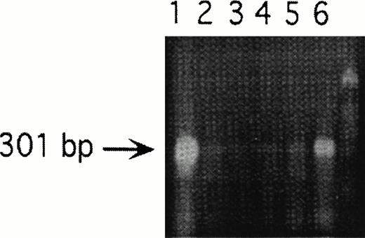 Fig. 3. RT-PCR of endogenous PAR-1 after transfection with antisense constructs, demonstrating relative loss of endogenous PAR-1. Lane 1, pCDNA3 containing PAR-1 cDNA; lanes 2, 3, 4, and 5, antisense constructs A2, A12, A18, and A57, respectively; lane 6, wild-type B16; and unmarked lane 7, molecular weight markers. A12 (lane 3) was used for the in vitro and in vivo antisense experiments.