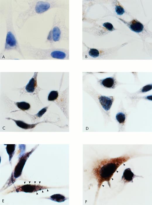 Fig. 4. Immunocytochemistry for PAR-1 in B16F10 cells transfected with S14 PAR-1, antisense A12, and mock plasmid. Cells were subcultured onto chamber slides, fixed, washed, and stained with a rabbit antirat PAR-1 Ab. PAR-1 binding was detected with a goat antirabbit biotinylated Ab, followed by avidin-biotin-HRP and appropriate chromagen. Cells were counterstained with hematoxylin. (A) Negative control with absence of primary Ab. (B) Wild-type B16F10. (C) Mock plasmid-transfected cells. (D) Antisense A12. (E and F) S14 cells. Note membrane (arrows) as well as intracytoplasmic positive brown staining of PAR-1. Original magnification × 1,500.