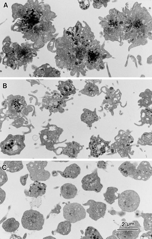 Fig. 8. Effects of DCB or bepridil on morphological changes evoked by thrombin. Washed platelets shown in Fig 7 were stimulated by 0.1 U/mL thrombin under unstirring condition. After 15 minutes of incubation, equal volume of 4% glutaraldehyde containing phosphate buffer was added to each aliquot. Electron microscopic analysis was performed as described in Materials and Methods.