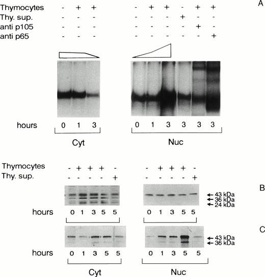 Fig. 1. NF-κB binding activity and NF-IL6 phosphorylation in TEC after adhesion to normal thymocytes. (A) NF-κB binding activity of cytoplasmic (Cyt) and nuclear (Nuc) extracts of TEC untreated, cocultured with freshly isolated thymocyte for 1 and 3 hours or incubated with thymocyte supernatant (Thy.sup) for 3 hours. Thymocyte supernatant was obtained from thymocytes cocultured with TEC for 12 hours. EMSA were performed with 6 μg of cell extracts probed with the32P-labeled IL6-κB oligonucleotide. Cytoplasmic proteins were treated with 0.2% deoxycholic acid before binding to dissociate NF-κB/IκB inhibitors. Nuclear complexes contained p50 and p65 subunits, as assessed by the band supershifting obtained with anti-p105 or anti-p65 antisera. DNA binding activity was quantitated by gel densitometry and expressed as a percentage of untreated controls (top of the gels). (B and C) PAGE analysis of NF-IL6 phosphorylation and isoform composition of cytoplasmic and nuclear extracts prepared from14C-leucine–labeled TEC untreated and cocultured with thymocytes for 1, 3, and 5 hours or incubated with thymocyte supernatants for 5 hours. (B) Immunoblotting of cytoplasmic and nuclear lysate (20 μg) probed with the anti–NF-IL6 antiserum. (C) Immunoblotting of cytoplasmic and nuclear NF-IL6-immunoprecipitates (103 cpm/lane) probed with antiphosphoserine MoAbs. Arrowheads indicate the positions of proteins with apparent molecular weights of 24, 36, and 43 kD. Sections of gels are shown. The results are representative of at least three experiments performed independently by using TEC and thymocytes derived from different donors.
