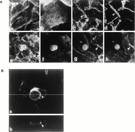 Fig. 2. Immunostaining of thymo-epithelial cocultures. All the experiments were performed on cells cultured at 37°C under standard incubation conditions as described in Materials and Methods. (A) a through d: immunostaining of TEC monolayers for F-actin (a and c), β4 (b), and 3 (d). β4 and 3 stainings are shown coupled to their F-actin stainings (a and c, respectively). Frames a and b were focused at the basal surface of TEC monolayers to show the complementary distribution of F-actin with β4, showing that β4 is excluded from F-actin–rich areas. Frames c and d were focused slightly above the plane of adhesion to show intercellular boundaries. e through l: immunostaining of TEC thymocytes cocultures for F-actin (e and g), β4 (f), and 3 (h). Frames e through h were all focused above the basal surface of TEC monolayers to show the aggregation of β4 (f) and 3 (h) at TEC-thymocyte interface. Arrowheads in g and h show a TEC intercellular boundary that is still in focus. (B) Confocal analysis of β4 enrichment at TEC-thymocyte interface (a). Digital reconstruction and rotation at the dotted line (a) to show the z axis (b) confirm β4 enrichment at the TEC-thymocyte interface. Arrowheads in a and b indicate the same position before and after rotation.