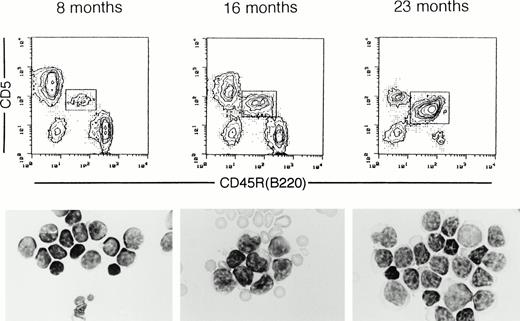 Fig. 5. Representative flow cytometry profiles and blood films of peripheral blood lymphocytes from a single (NZW x B10.NZW) F1 x B10.NZW backcross mouse carrying all Bpal-1, -2 and -3 alleles, at 8, 16, and 23 months of age. CD5+ B-1 cells are boxed. Cytospinned lymphocyte films were stained with Giemsa. Proportions of B-1 cells in total peripheral B cells and total white blood cell counts were 11% and 7,200/mm3 in mice at 8 months, 44% and 7,000/mm3 at 16 months, and 97% and 35,500/mm3at 23 months of age, respectively.